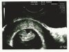 Echo 8wk 1dg - CRL 1,67cm.jpg
