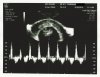 Echo 8wk 1dg - hartactiviteit.jpg