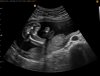 ECHOWONDER_0025.jpg