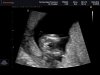 BABY_0004.jpg