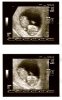 Echo-10wk-3dg-pr.jpg