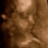 baby25w2d.jpg