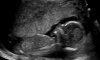 BABY-_V-VD-_STADT_20140325_ABD-_OBST_0012.jpg