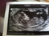 baby1.jpg
