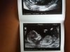 baby2.jpg
