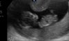 baby1.jpg