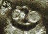 Baby.jpg