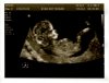 Echo9april-2-pr.jpg