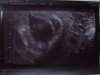 114657-8090412.jpg