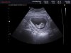ECHOBABYBREDA_0007.jpg