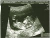 echo3_23april.jpg
