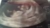 386876d1396515010-babyangel-nub-voorspelling-20140403_095953.jpg
