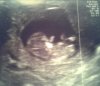 Echo 10 wk + 4 dgn.jpg