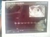 02052014 First echo - 6 mm tall - 6+1 weeks - first heartbeat.jpg