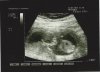 14-05-14 (14 wk).jpg