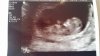 IMG-20140527-WA0000.jpg