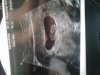 baby8wk.jpg