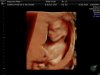 babyboy 012.jpg