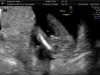 babyboy 011.jpg