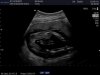 Kimberly_20140602__0006.jpg