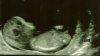 baby.jpg