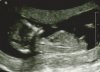 Scan Spekkie 3 (2).jpg