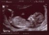 Echo 13-7-12.jpg