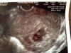 Echo 1 16-07-2012 6 weken 5 dagen.jpg