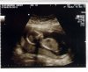 baby Jaspers 16 weken solo foto.jpg