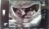 echo 11wk.jpg