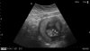 foto-babyboy.jpg