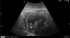 foto-babyboy2.jpg