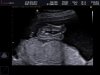 BABY AKSAKAL_0015.jpg