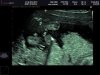 BABY AKSAKAL_0006.jpg