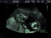 BABY AKSAKAL_0003.jpg