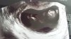 20140610_195536.jpg