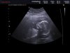 ECHOBABYBREDA_0014.jpg