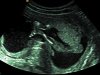 BABY WILBRINK_0003.jpg