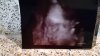 baby.jpg