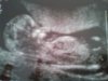 Echo 30-06-2014 2.jpg