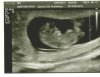 Scan.jpg