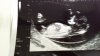 20140706_080555.jpg