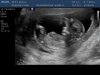 baby.jpg