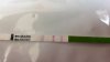 CD10IUI1Follikelrechts21mm.jpg