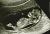 Scanskelet12wk.jpg