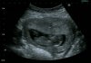 Baby 12 weken.jpg