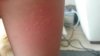 20140725_080442.jpg
