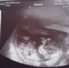 baby2nub.jpg