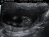 BABY VAN DER HOORN_4.jpg