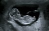 baby2.jpg